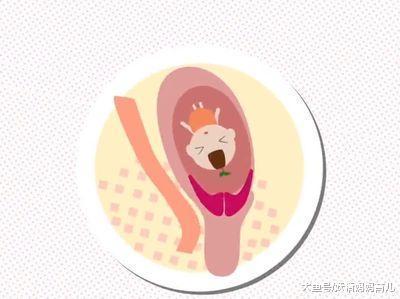 胎儿难产的5大原因, 孕期做好这三点, 分娩更顺利