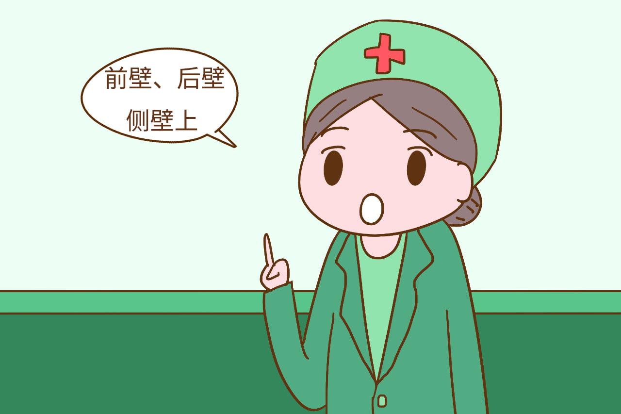 胎盘在子宫内的位置, 对孕妈的影响有很大不同, 你的胎盘在哪里