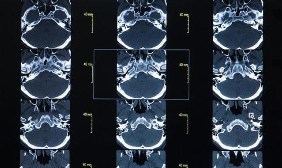 10岁男孩晕倒, 抢救无效死亡, 医生说: 都怪父母疏忽了一件事!