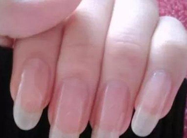 提醒: 指甲如果长成这5种样子, 说明你的身体状况, 可能不是太好