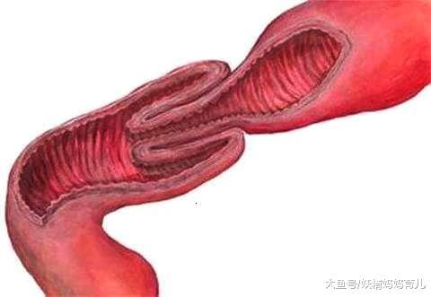 宝宝得了鹅口疮怎么办? 5个月宝宝常见6个异常症状和护理技巧