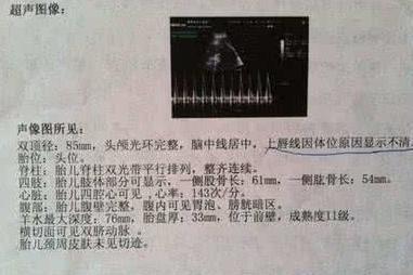 孕40周2天, 顺产6斤男宝宝, 附孕期B超单