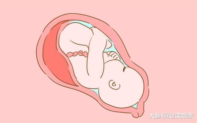 孕妈如果有这些症状, 最好选剖腹产