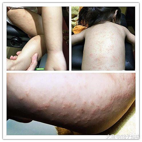 超常见的植物竟有毒! 妈妈发文提醒: 小心别碰