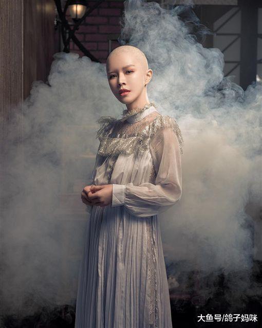 崔咪化疗光头照绝美曝光! 勇敢分享: 越害怕就越要去面对