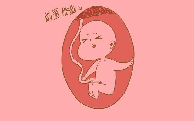 如果你是这几类孕妈, 想让宝宝平安生产, 就别执拗顺产, 该剖就剖