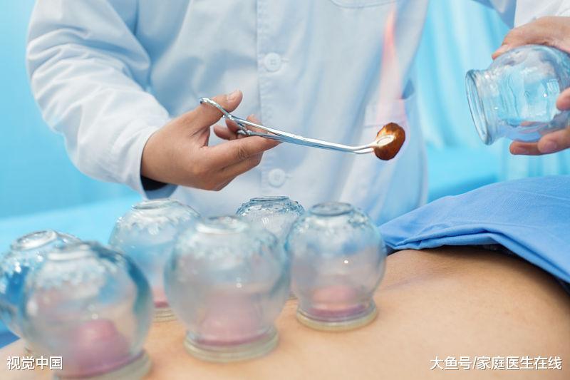 拔罐什么原理是什么_拔罐后出血是什么原因(2)