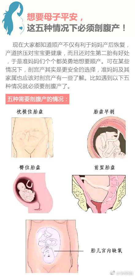 想要母子平安, 这五种情况下最好还是剖腹产!