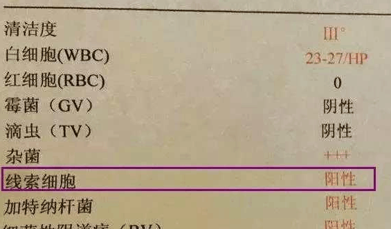 妇科检查单上的“+”号, 居然代表这个, 难怪医生从不当面说