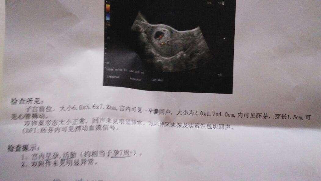 孕囊数据看男女, 真的准吗?