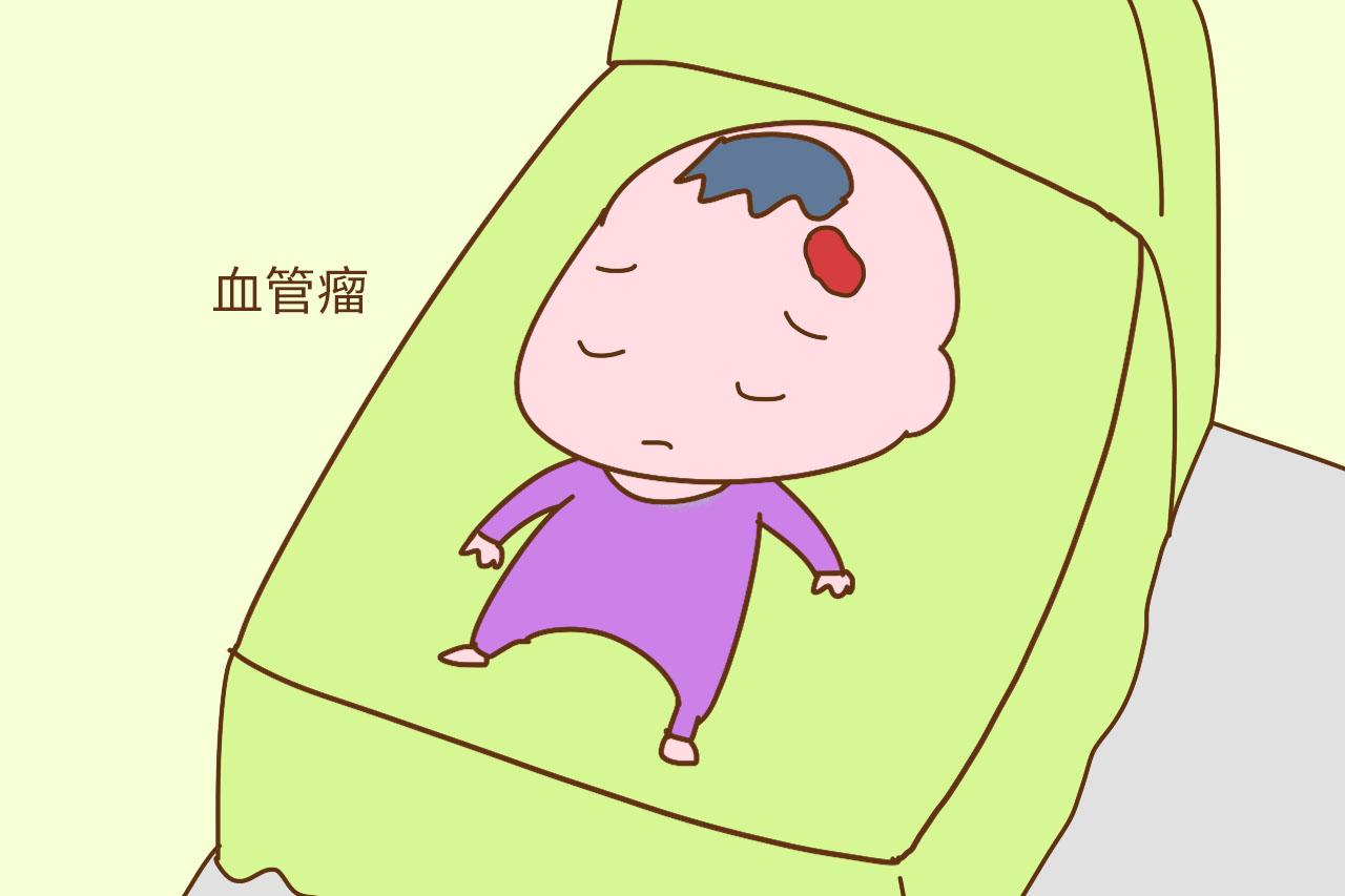 事关宝宝无小事, 这3种胎记就存在健康隐患, 妈妈们别掉以轻心