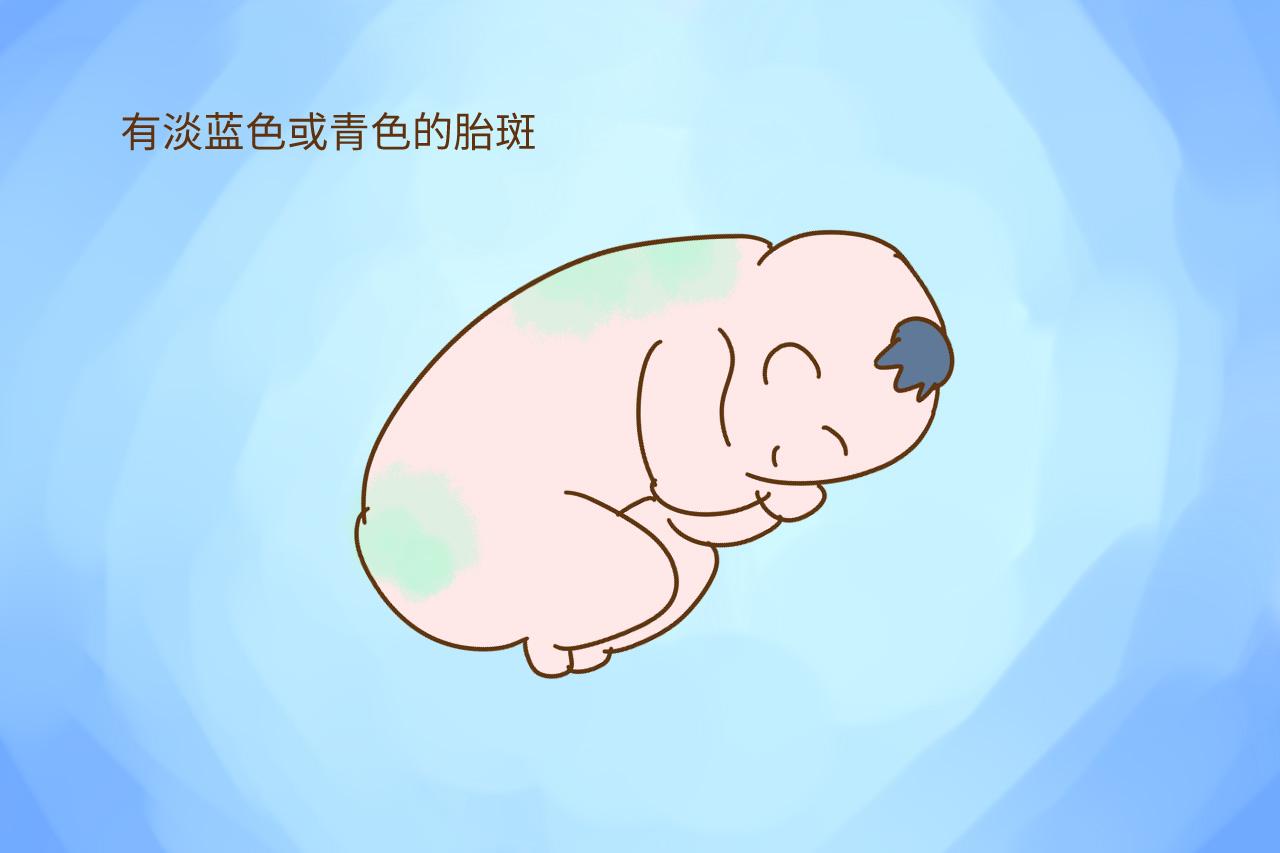 教育专家: 想让孩子出生更聪明, 孕妈妈在这一项上不能懒