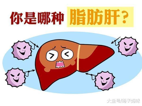 脂肪肝患者过亿, 这些高危因素你中了几个?