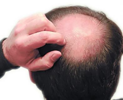 医生提醒: 选另一半要小心, 这些疾病会隔代遗传, 禁止近亲结婚!