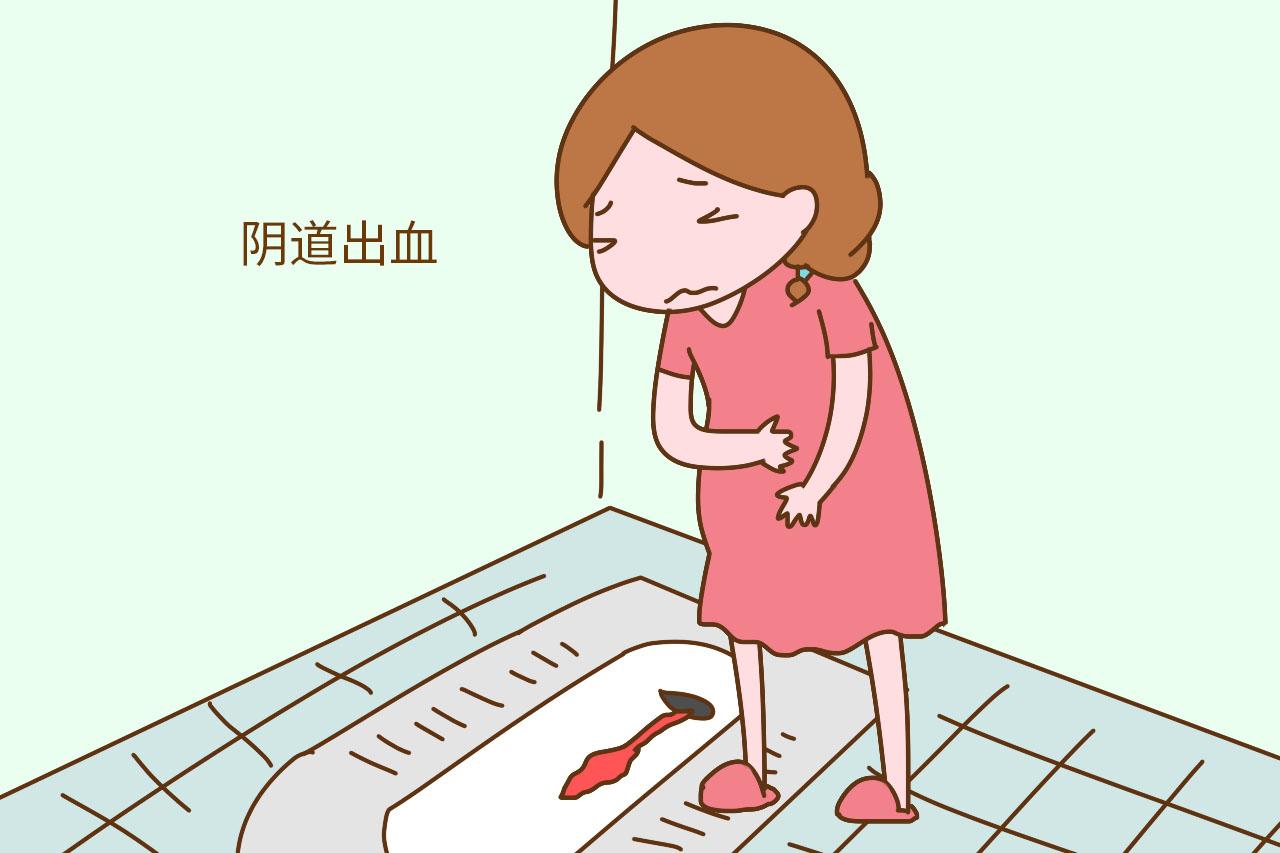 孕初期有这个症状, 孕妈别大意, 要及时就医