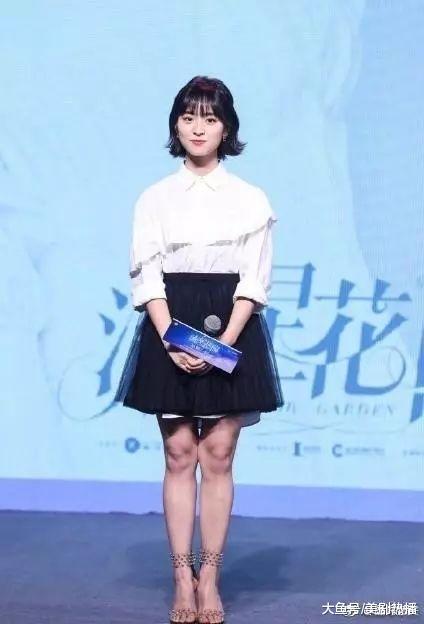 沈月与新F4出席活动, 但她的小腿这是怎么了, 简直不忍直视!