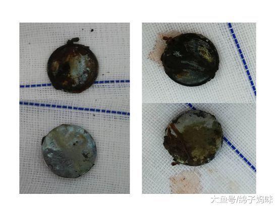 纽扣式电池, 小儿异物中的危险分子