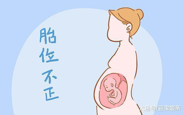 顺产虽然很好, 但是有这三种情况的孕妈, 最好不要选择