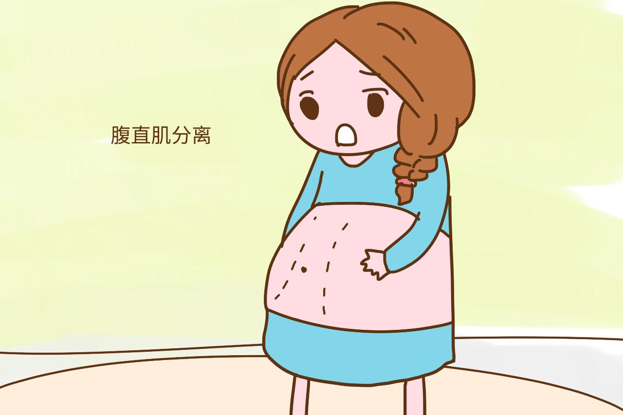 产后别忙减肚子, 先查查有没有腹直肌分离, 否则肚子越减越大