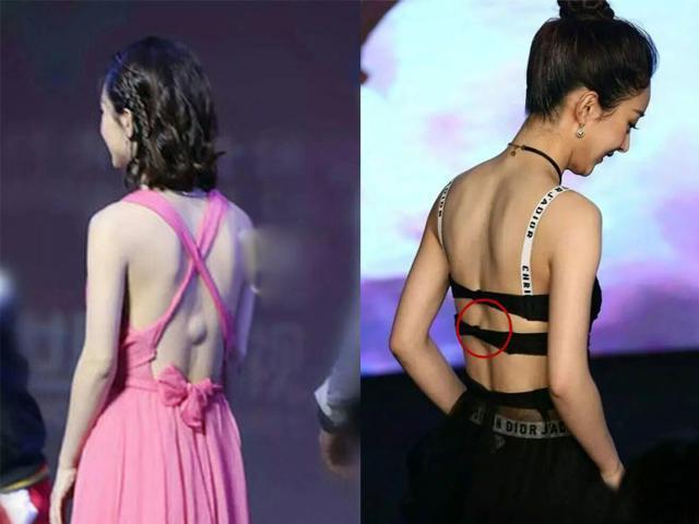 赵丽颖宣布短期内不再接剧: 治疗腰伤, 切除肿块! 为丽颖祈福