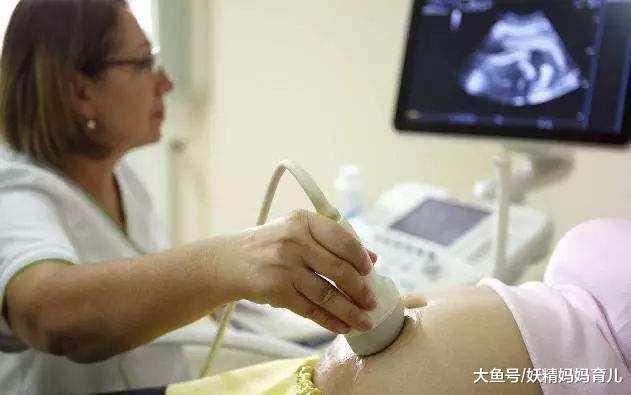 产检B超有哪些作用? 3分钟让你看懂B超单