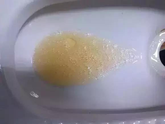 男人晨起, 如果没有出现4个症状, 恭喜, 你的身体还算健康