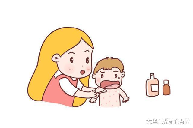 夏季皮肤大作战, 痱子湿疹统统拿下!