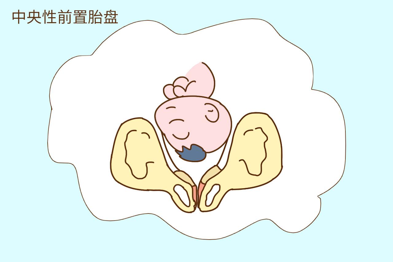 孕期运动好处多, 但这几种孕妈最好别碰, 可能会有危险