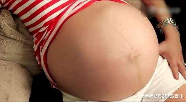 双胞胎真的是受一次罪, 生两个娃这么简单? 医生可不这么想