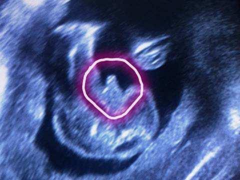 孕妈总结判断男女可靠的8种方法