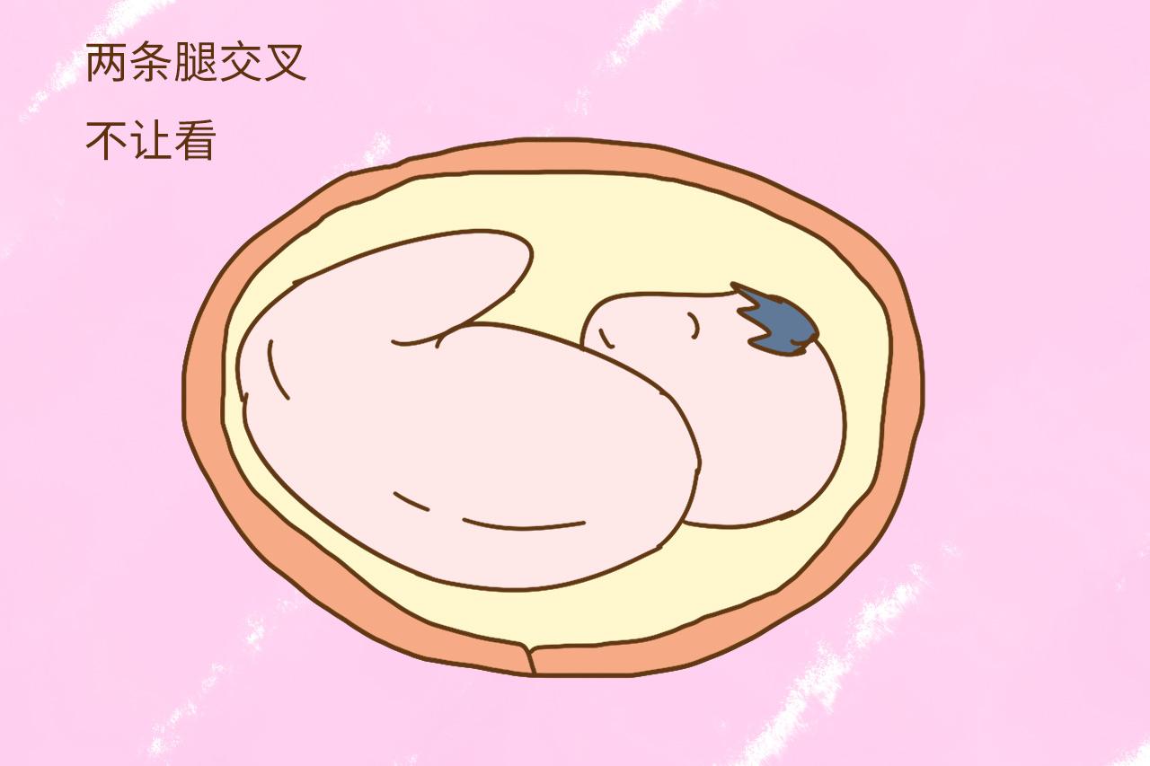 拍四维的时候, 你家宝胎宝在干什么? 胎宝: 别耽误我摆姿势