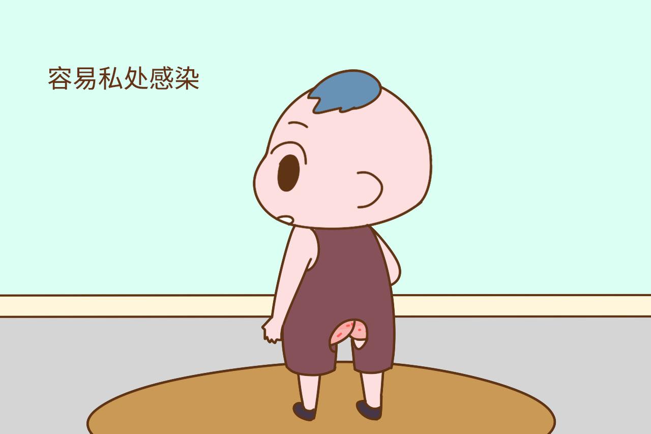 宝宝多大开始穿内裤最好? 最晚别超过这个年龄, 危害很大