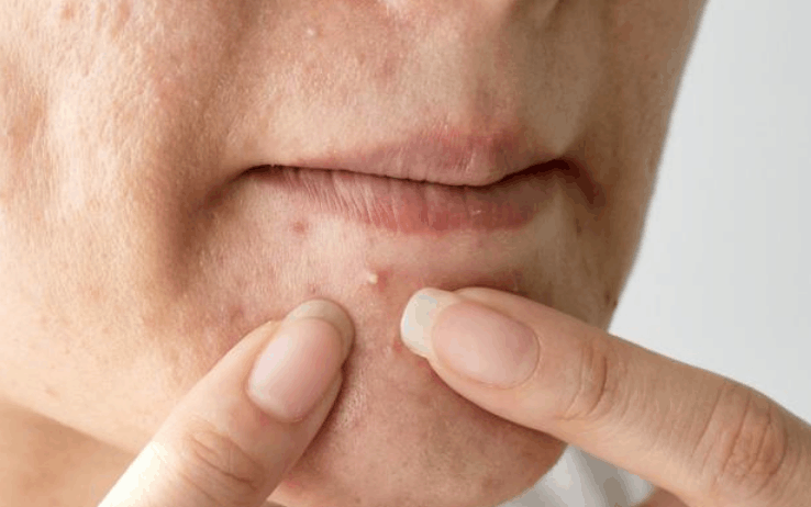 女人子宫好不好, 看看脸就知道, 若没这3种症状, “子宫”还很温暖