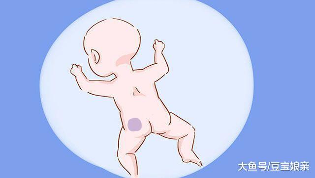 娃长了这几种胎记, 宝妈别再发愁怎么去掉