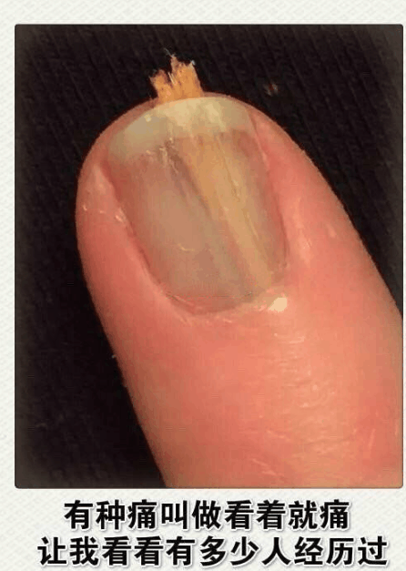 看着就疼