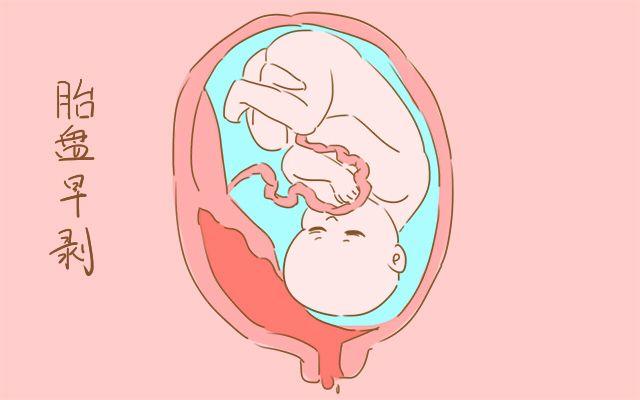 孕晚期, 这个病症很严重, 不注意, 可能会危及胎儿和妈妈生命