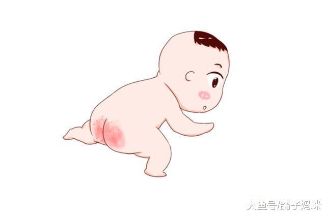 宝宝为什么红屁股? 如何防治?