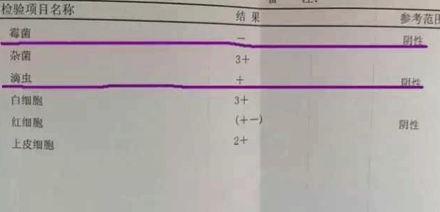妇科检查单上的“+”号, 居然代表这个, 难怪医生从不当面说