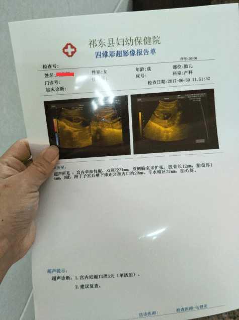 怀孕以后如果有这八种症状, 小王子的面大