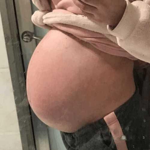 剖腹产6.6斤大眼睛男宝一枚, 太可爱了, 附孕期症状