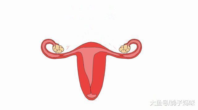流产之后, 去美容院保养卵巢, 致黄体囊肿破裂!