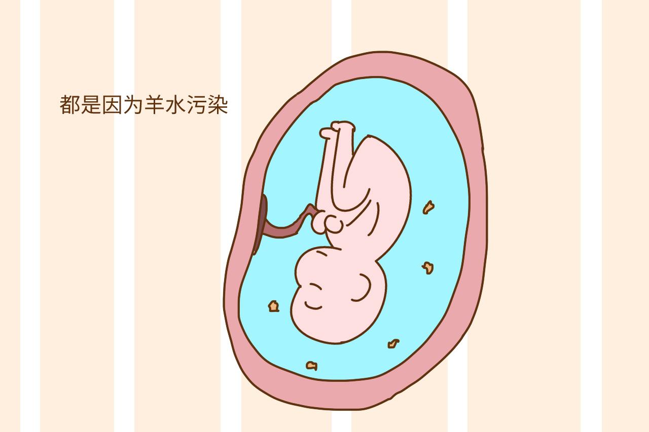 顺产条件具备, 能不能成功还得看这个, 很多孕妈顺转剖就是因为它