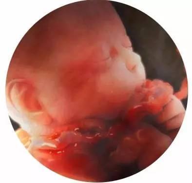 顺利产下男宝一枚, 对上了很多怀男宝的症状! 附特征