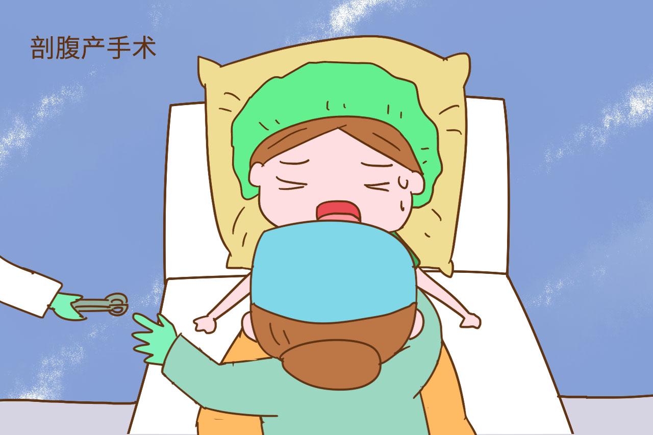 决定剖腹产的孕妈, 手术前多一个动作对你和宝宝有好处