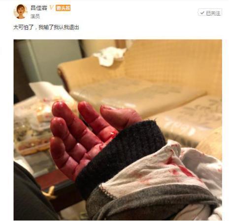 曾力挺李小璐的百变御姐吕佳容凌晨发割腕照片, 并发文怀念乔任梁