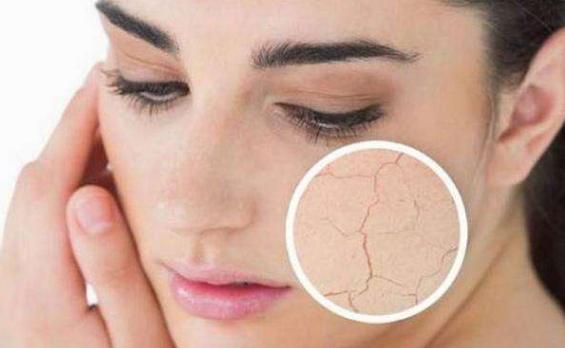 鼻子出血不重视, 你还觉得是小事吗? 这些情况你需要了解!