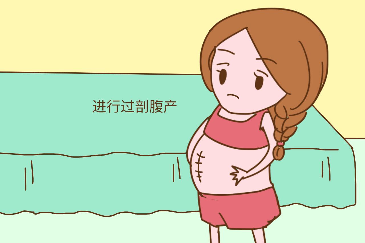 这几种情况一出现, 准妈妈们别犹豫, 直接选择剖腹产
