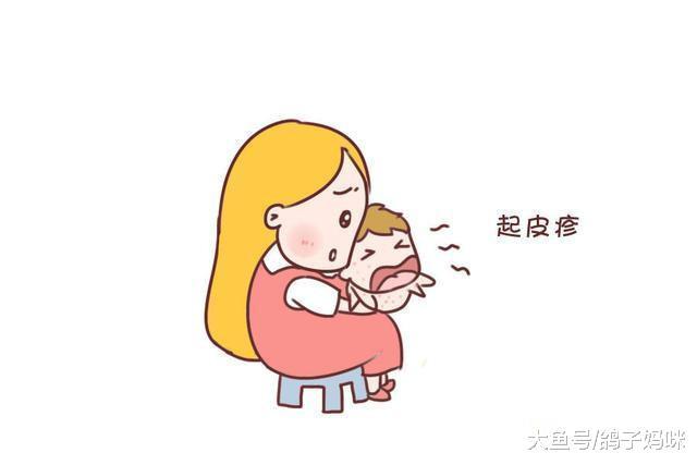 痒痒痒, 宝宝常出红疹子, 这四种阶梯方法很有效!