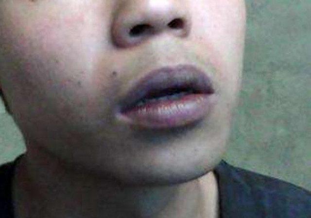 肝不好的人, 脸部可能会出现这几个变化, 看看你有吗?