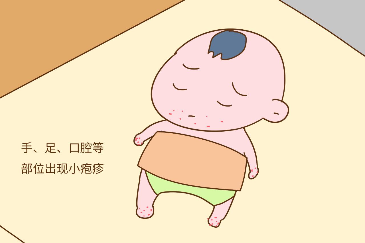 夏季, 宝宝手足口病“大高峰”, 这些家庭护理方式尽早收藏